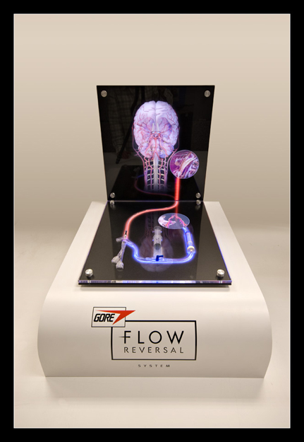 Inflatable Aortic Stent